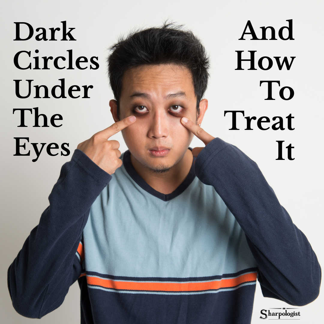 What’s The Deal With Dark Circles And Bags Under My Eyes?