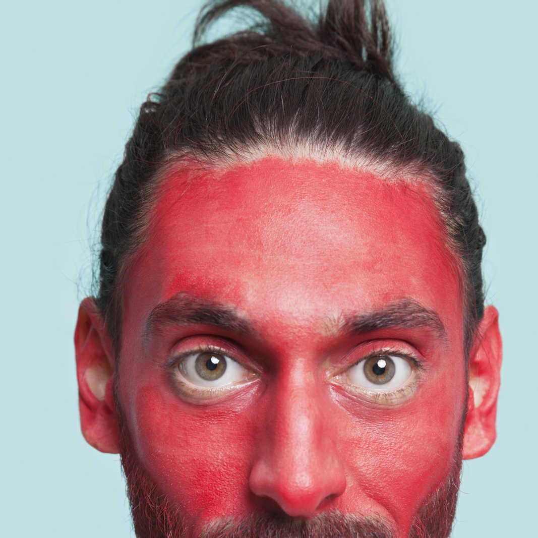 man with red face