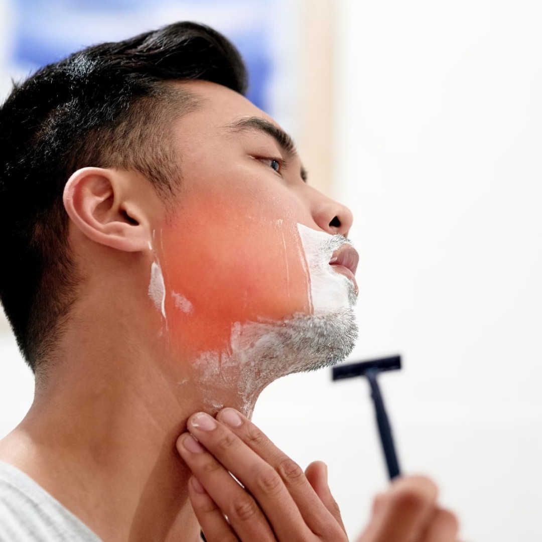 5 Common Causes Of Skin Irritation After Shaving