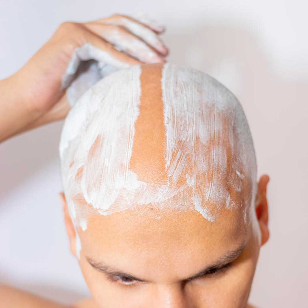 Bald Head Care for Men Tips, Products, More Sharpologist