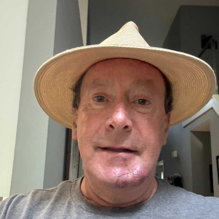 wear a hat