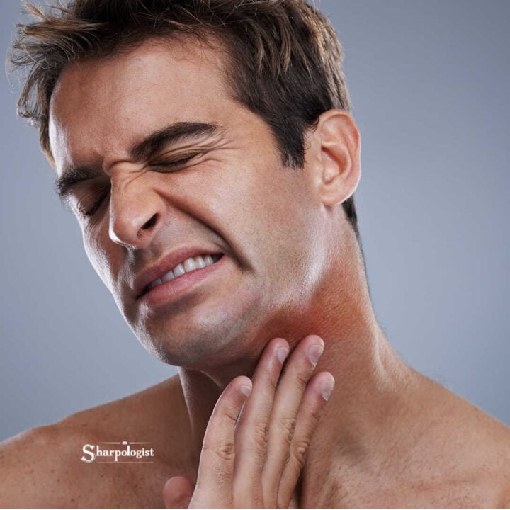 man with razor burn on neck